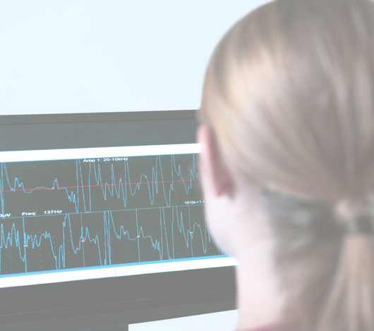 Electromiografía (EMG) de N. facial (Depende cuantos lados )